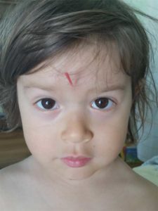 Santa Cruz Family Acupuncture - Pediatric Acupuncture